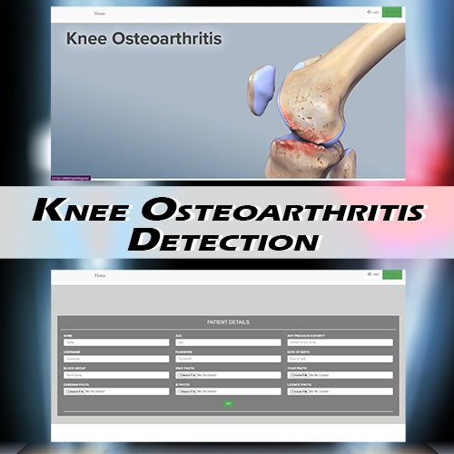 Nevon Knee Osteoarthritis Detection Python